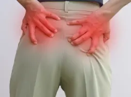 Piriformis sindrom kolka