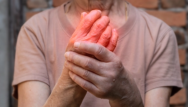 Artritis Zapestja – Simptomi, obvladovanje in rehabilitacija