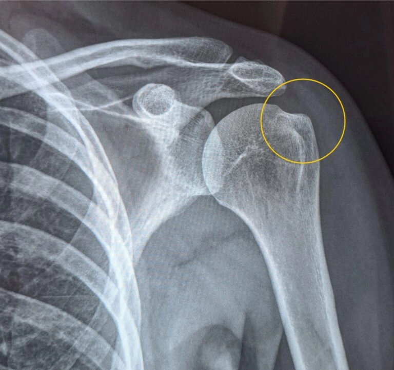 rezultati fizioterapije meridian-fit