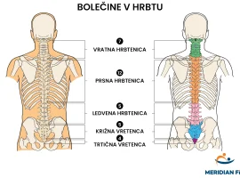 bolečine-v-hrbtu