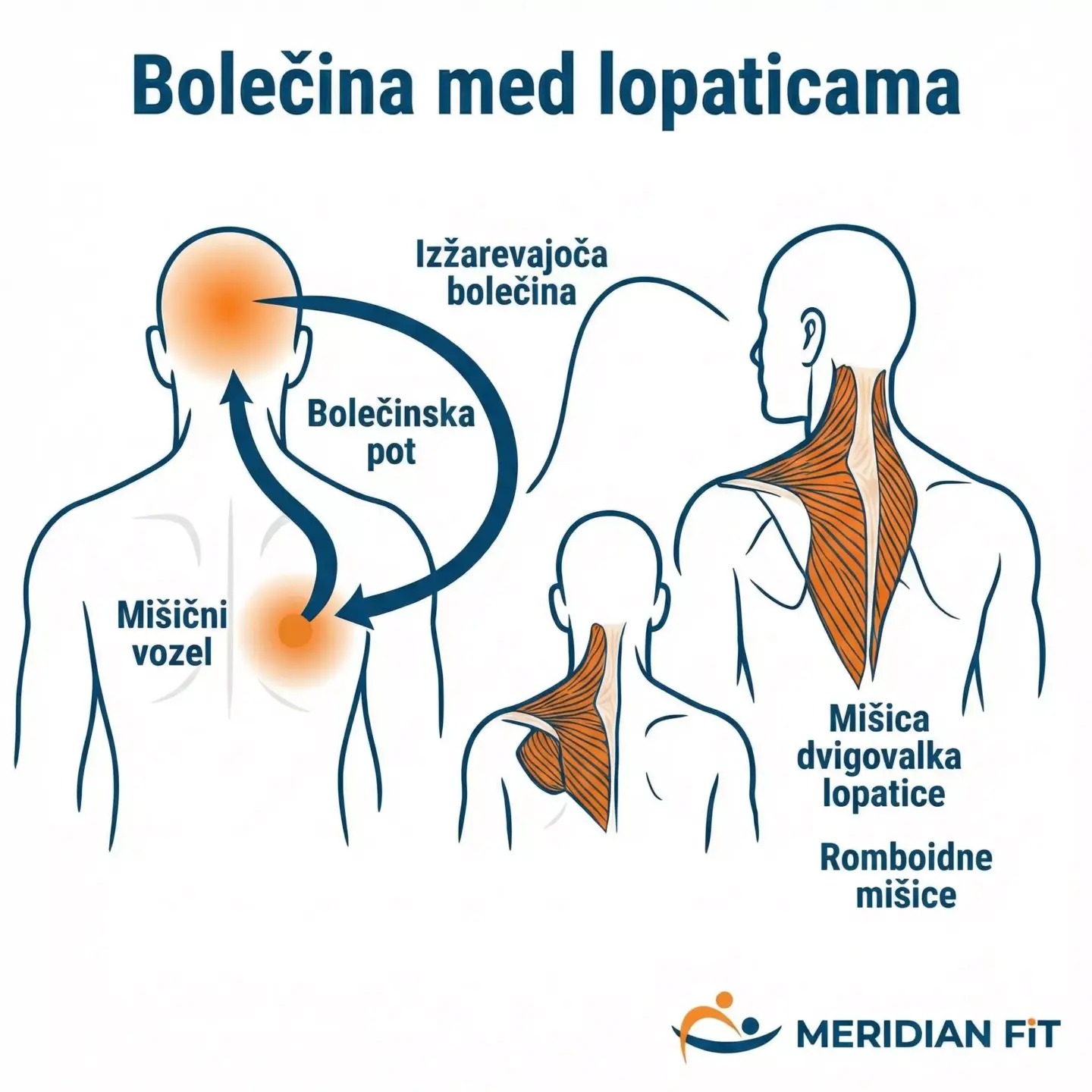 bolecine-v-hrbtu-med-lopaticami