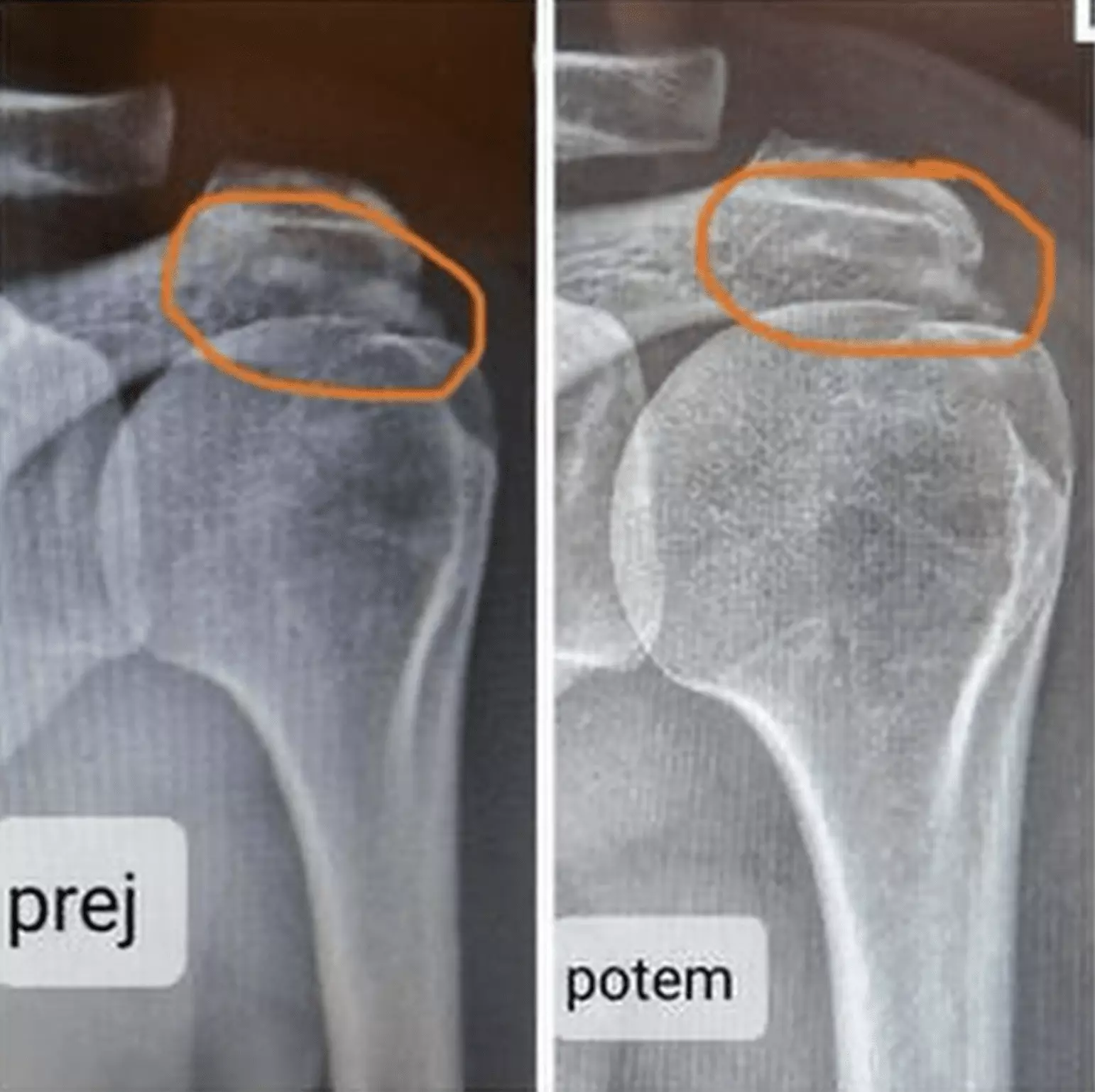 rezultati-zdravljenja-v-kliniki-meridian-fit
